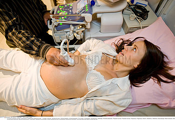 Foetal ultrasound scan