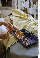 Organ transplantation