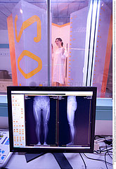 EOS biplanar X-ray scanner