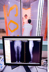 EOS biplanar X-ray scanner