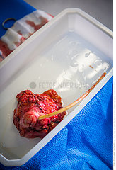 Urologic surgery