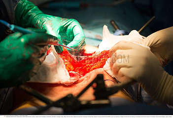 Reconstructive surgery