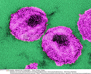 Human immunodeficiency virus (HIV)
