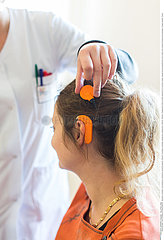Reportage_207 Cochleaimplantat /Cochlear implant