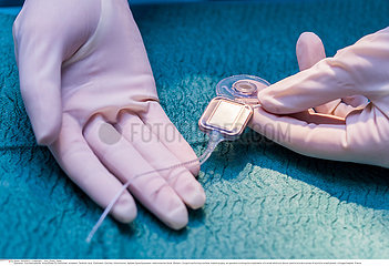 Reportage_207 Cochleaimplantat /Cochlear implant