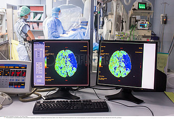 Reportage_208 Neurovaskuläre Station / Interventional neuroradiology