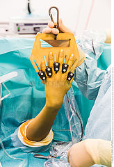 Reportage_212 Arthroskopie Handgelenk / Arthroscopic surgery