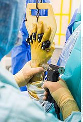 Reportage_212 Arthroskopie Handgelenk / Hand arthroscopy
