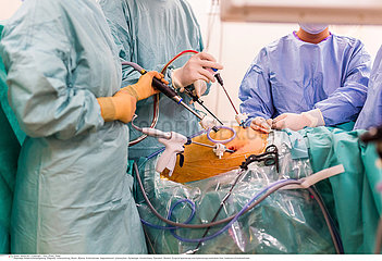 Gynecology surgery