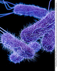Drug-resistant Salmonella bacteria.