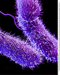 Drug-resistant Salmonella bacteria.