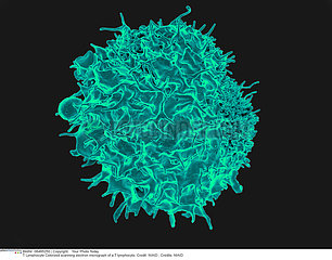 T lymphocyte