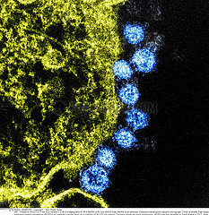 MERS Virus Particles