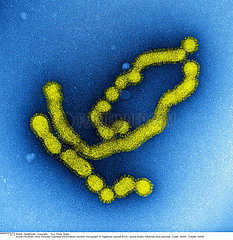 Swine Flu Virus