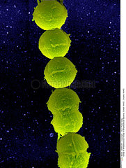 Group B Streptococcus
