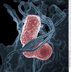 Klebsiella pneumoniae Bacteria
