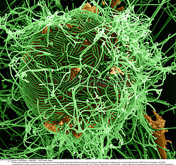 Ebola Virus Particles