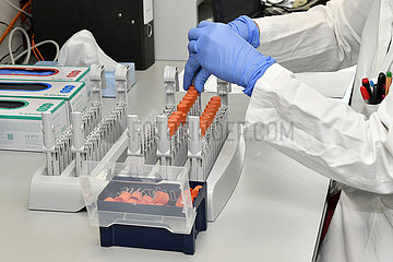 Deutschland  Nordrhein-Westfalen  Essen -SARS-CoV-2 Testuntersuchungen in der Virologie des Universitaetsklinikums Essen