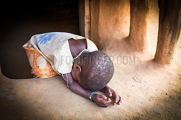 Malaria - Kleinkind mit hohem Fieber