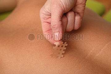Berlin  Deutschland  Akupunktur-Pflaster wird auf menschliche Haut geklebt