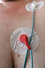 Berlin  Deutschland  EKG-Elektroden auf menschlicher Haut